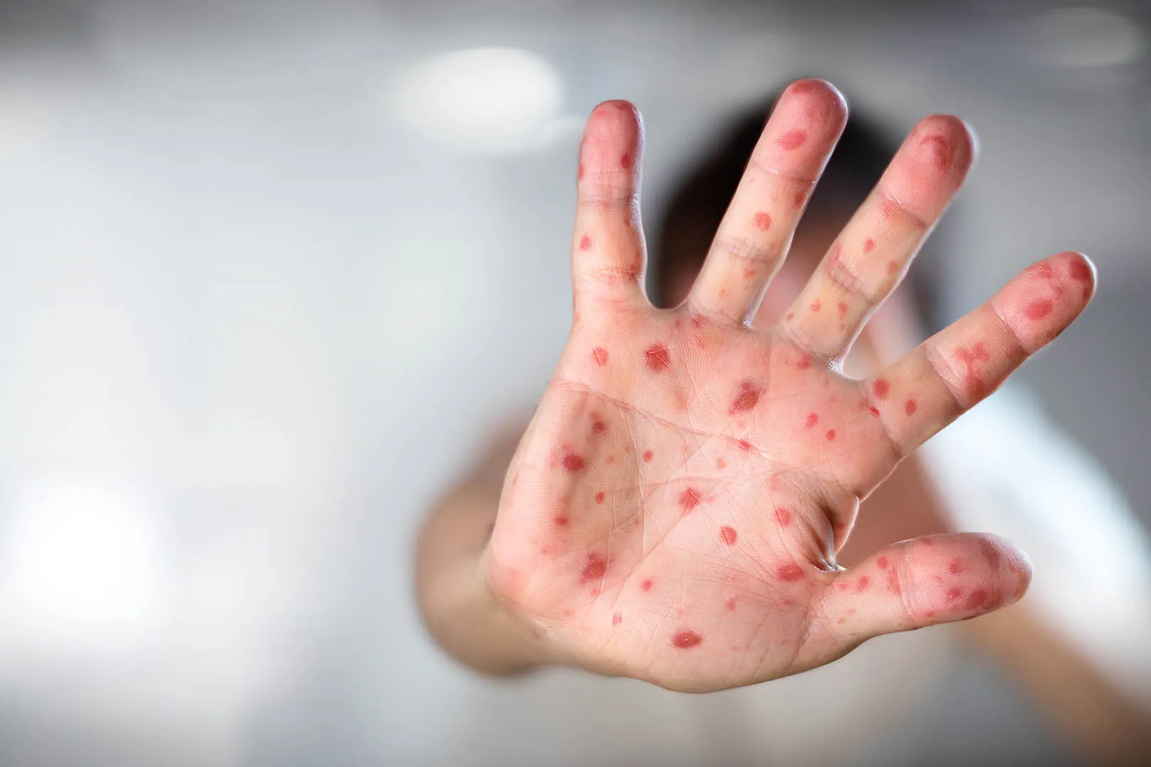 Obat Flu Singapura di Apotik Terbaik untuk Anak dan Dewasa